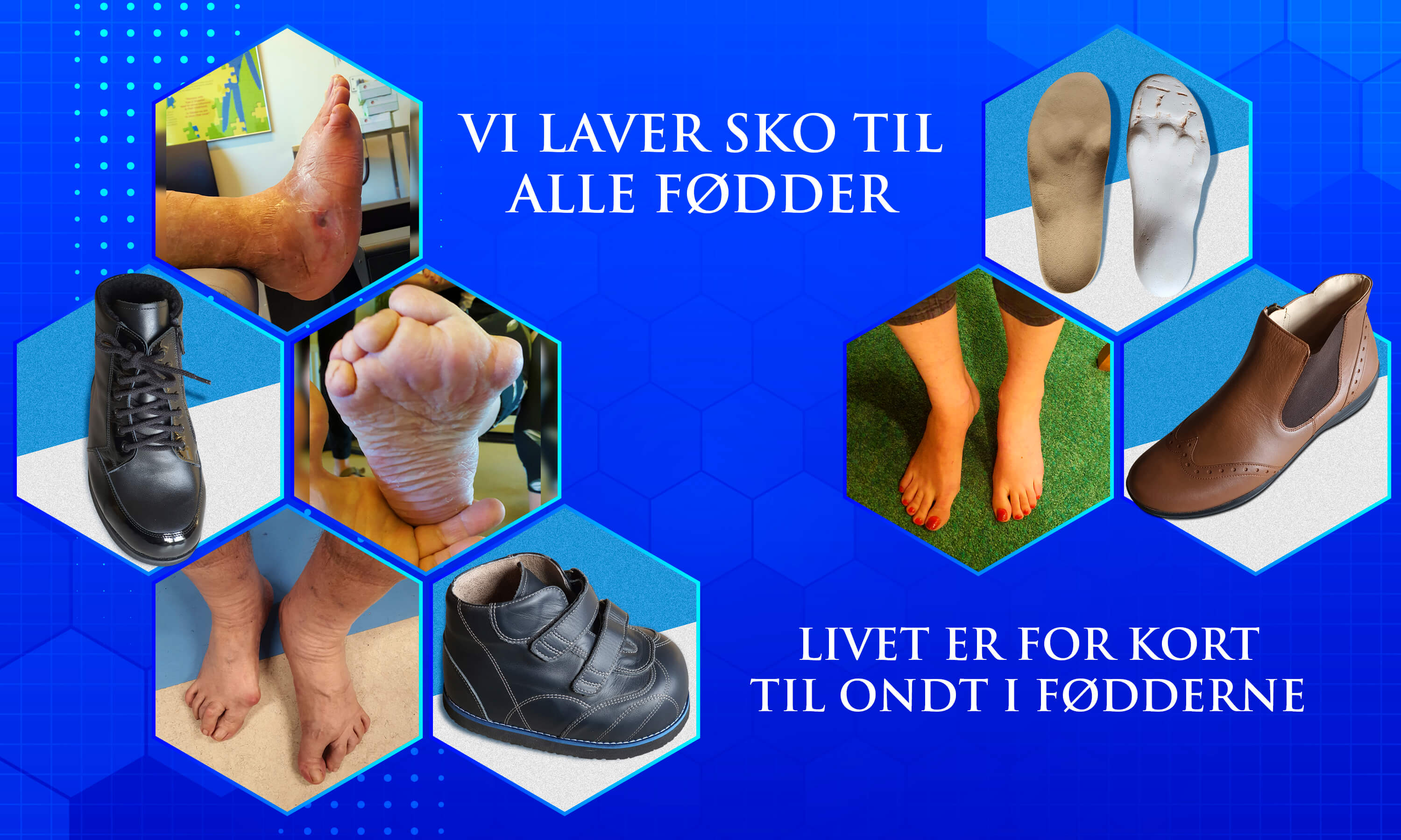 Frivillig hovedlandet procedure Velkommen til Fynske Special Sko. Skomager - bandagist - fodterapeut